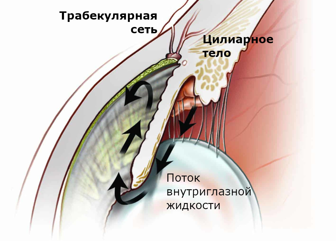 СЛТ (селективная лазерная трабекулопластика при глаукоме)